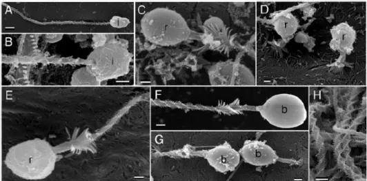 Figura 10 – Fotomicrografia em MEV dos nematocistos da C. mosaicus (Peach &amp; Pitt, 2005)