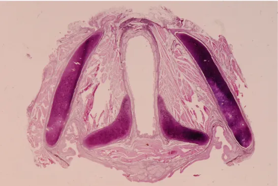 Figura 3 - Corte histológico horizontal  (coloração elastina) de uma laringe de adulto ao  nível da transiçãoo glote/subglote em que se identifica a disposição da estrutura da  corda vocal e do cone elásticp