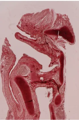 Figura 2 - Corte histológico parafrontal (Coloração Van Gieson) de uma laringe de adulto em que se  identifica a disposição da estrutura elástica nos três andares da laringe