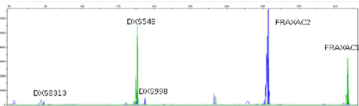 Figura  5  Electroferograma  observado  através  do  programa  Gene  Mapper  dos  produtos  de  PCR  resultantes da amplificação dos 5 marcadores moleculares em Multiplex