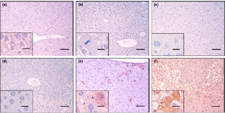 Figure 4 N-diethylnitrosamine-exposed mouse liver. Immunostaining for CK7-Mayer’s haematoxylin, 100x, bars 