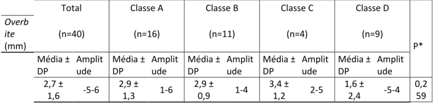 Tabela 3 - Estatística descritiva de overbite (mm) segundo a classe de instrumento de sopro