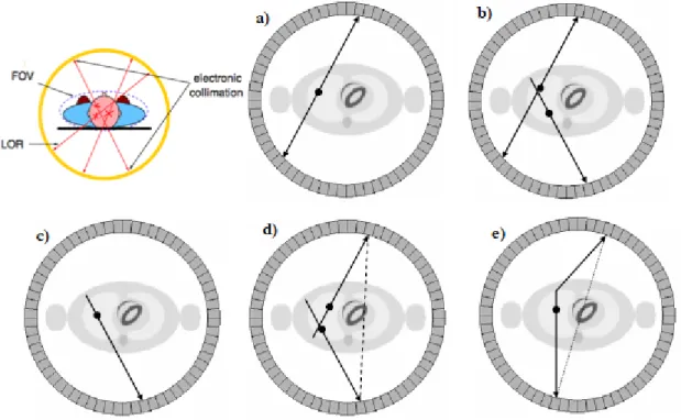 Figure 2.7: Illustration of the main coincidence event types: a) true; b) multiple; c) single; d) random and e) scattered.