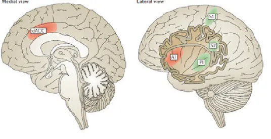 Figure 2: The lateral pain system, processing sensory components of pain (green: primary  somatosensory  cortex,  S1,  secondary  somatosensory  cortex  S2,  posterior  insula  PI)  and  the medial  pain system  processing emotional-cognitive components of