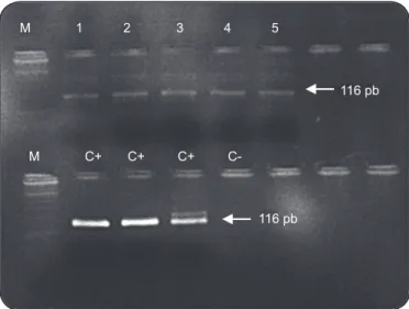 FIGURE 1 - Electrophoretic analysis of PCR 13a/13b fragments. 
