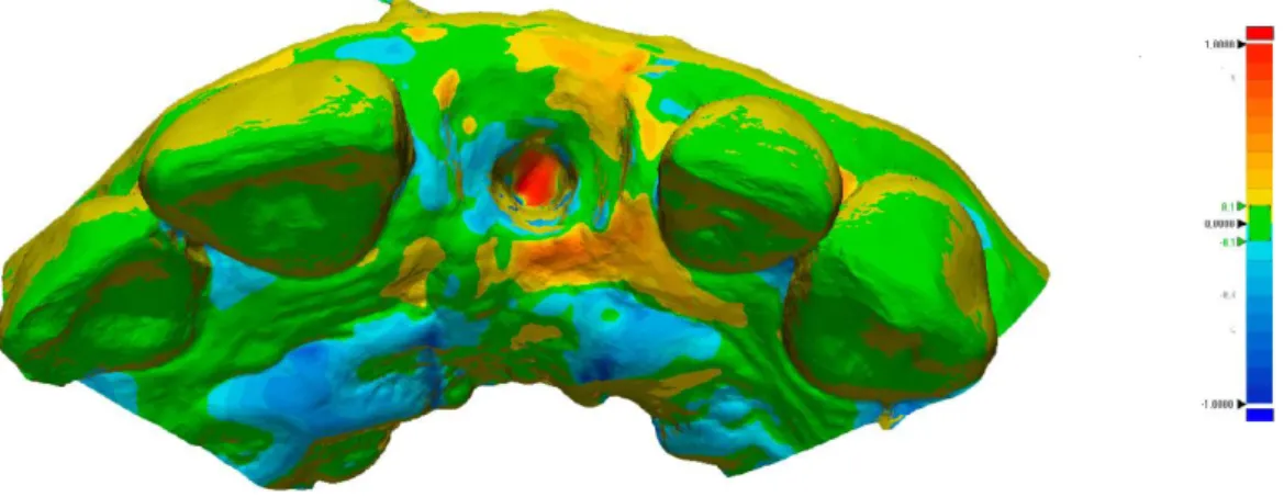 Figure 5 – Example of 3D visualization with “3D Compare” tool. Specific parameters were set  to the color scale, ranging from +1000 to -1000 μm, and the best results ranging between +100 and -100  μm highlighted in green.