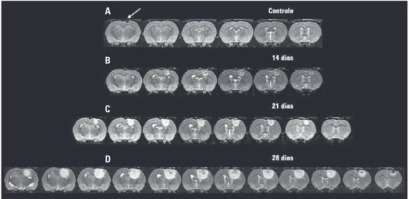 Figura 1. Evolução tumoral do modelo C6 acompanhada por imagem de ressonância magnética
