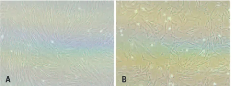 Figura 1. Células-tronco mesenquimais isoladas de amostras de cordão  umbilical. A) Cultura de CTM com aproximadamente 90% de confluência – 400x;  B) Cultura de CTM com aproximadamente 80% de confluência