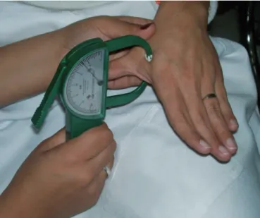 Figura 1. Mensuração da espessura do músculo adutor do polegar