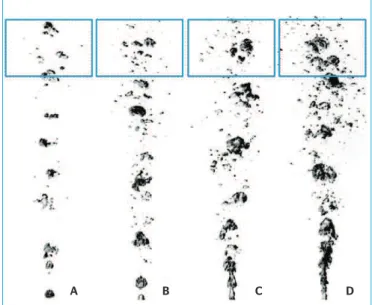 Figura 4 – Imagens das bolhas geradas com o orifício de diâmetro  d o  = 1,5 mm e diferentes vazões de ar: (A) Q=1 L.min