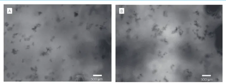 Figura 6 – Exemplos de imagens obtidas de flocos: Condição 1 (T=10 min/G=75 s -1  — A) e Condição 2 (T=17 min/G=60 s -1  — B).