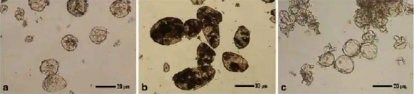 Fig.  10.  Optical  microscopy  images  of  xylan  microcapsules  produced  by  interfacial  cross- cross-linking polymerization with different lipophilic external phases (Nagashima et al., 2008)