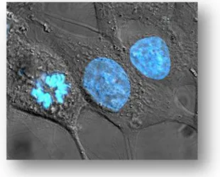 Figura 8.  Células HeLa coradas com Hoechst 33258.   Fonte: HeLa cells stained with Hoechst 33258.jpg|thumb|180px|Legenda 