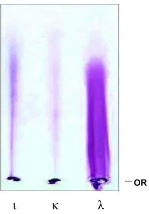FIGURA 3: Perfil eletroforético das carragenanas comerciais L, N, O (50 Pg de cada)  em gel de agarose, tampão PDA
