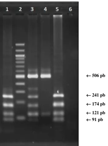 Figura 11 – Eletroforese horizontal em gel de agarose 2,0% de produtos de PCR digeridos 