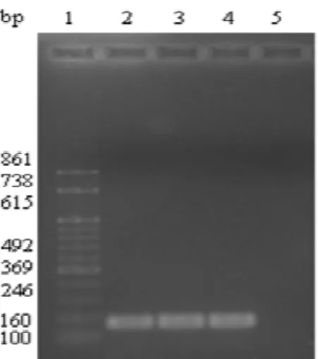 Figura  7:  Reação  em  Cadeia  da  Polimerase  (PCR)  para  as  amostras  de  ECN 