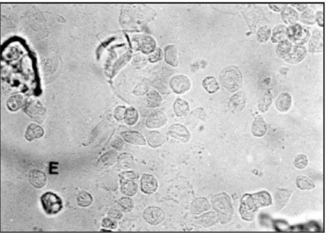 Figura 13- Microscopia do lavado vaginal de camundongos fêmeas no proestro. 