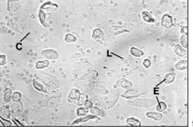 Figura 15- Microscopia do lavado vaginal de camundongos fêmeas no metaestro. 