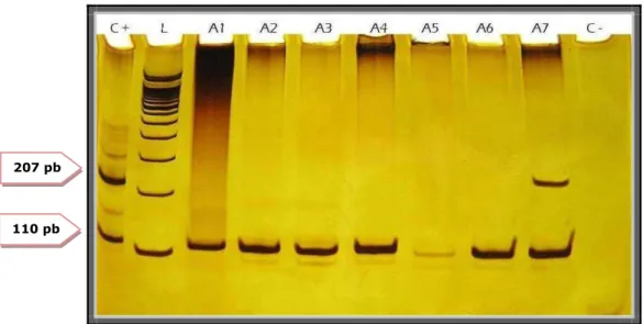 Figura  8:  Eletroforese  em  gel  de  poliacrilamida  para  HPV.  Linha  C-  :  controle  negativo;  A1  a  A7:  amostras  das  pacientes;  C+:  controle  positivo;  L:  padrão  de  peso  molecular