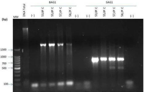 Figura 4: Eletroforese em gel de agarose 1% acrescido de Gel Red como marcador de DNA,  dos produtos de  PCR dos genes BAG1 e SAG1