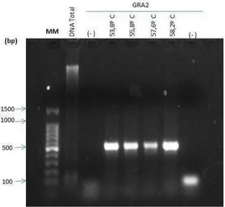 Figura  5:  Eletroforese  em  gel  de  agarose  1%  do  produto  de  PCR  do  gene  GRA2