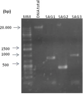 Figura 7: Resultado confirmativo de amplificação dos genes SAG1, SAG2 e SAG3 por eletroforese em gel de  agarose 1%