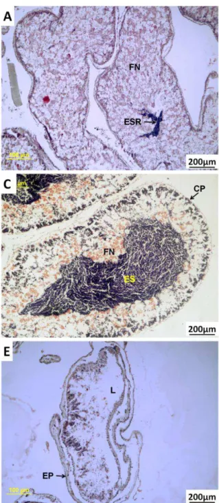 Figura 9: Estágios do ciclo gametogênico em  machos  de  T.  ventricosus  no  Arquipélago  de  Fernando  de  Noronha:  (A)  Reserva;  (B)  Proliferação;  (C)  Em  Maturação;  (D)  Maturação Máxima e (E) Emissão de  Gametas