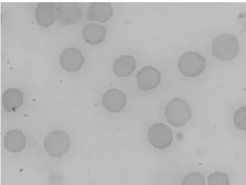 Figure 1: Samples of whole blood were incubated with NaCl 0.9% solution for 60 min.  After that, stannous chloride solution was added and the incubation continued for 60 min