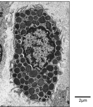 FIGURA 1 -  MICROFOTOGRAFIA ELETRÔNICA DE TRANSMISSÃO DE 