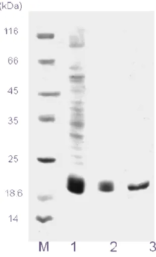 Fig.  4.  Eletroforese  das  etapas  de  purificação  do  SKTI  (SDS-PAGE  12%)  corado  com  comassie  blue  R-250;  (M)  Marcadores  de  massa  molecular:   β-galactosidase  (116  kDa),  albumina  sérica  bovina  (66  kDa),  ovalbumina  (45  kDa),  lacta