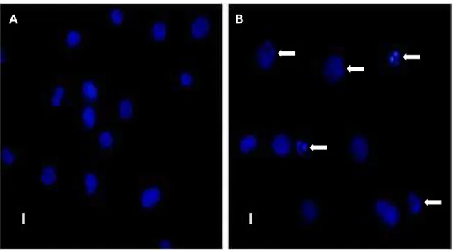 Figura 9: Alterações morfológicas típicas de apoptose induzida por CvL em células K562