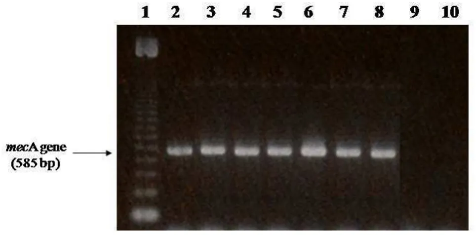 Figure 1. Gel image of representative PCR mecA gene products (585bp), Lane  1:  molecular  size  marker  (123bp);  Lanes  2-10:  isolates  BMB9393  (a  positive  control),  NT05,  NT11,  NT42,  NT76,  NT80,  NT99,  NT21  and  ATCC  25923  (a  negative cont