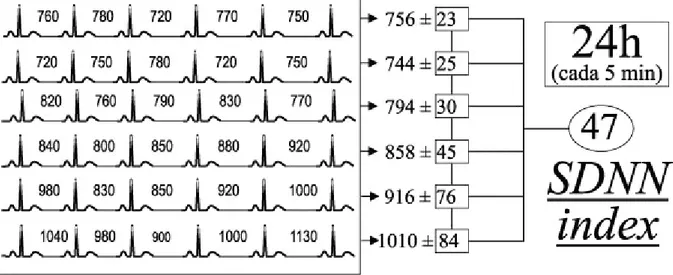 Figura  10:  SDNN  index  =  média  dos  desvios-padrão  dos  intervalos  RR  normais  a  cada  5  minutos, 