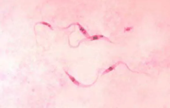 Figura 1 – Forma tripomastigota sanguínea de Trypanosoma cruzi.  (Fonte: pt.wikipedia.org) 