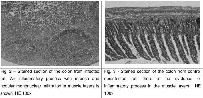 Fig.  2  – Stained section of the colon from infected  rat.  An  inflammatory  process  with  intense  and  nodular mononuclear infiltration in muscle layers  is  shown