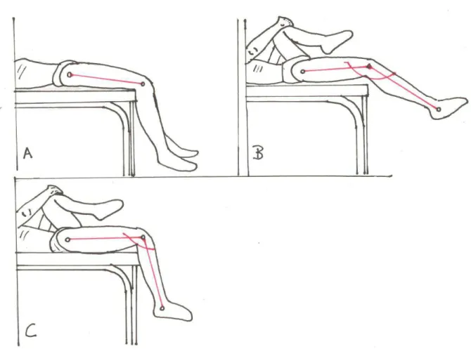 Figure 01- Figure-1 A) Posture adopted to perform the adapted Thomas test, to  evaluate  rectus  femorus  muscle  flexibility;  B)  Positive  Thomas  test,  with  contralateral leg extended, suggesting rectus femorus muscle shortening and C)  Negative Thom