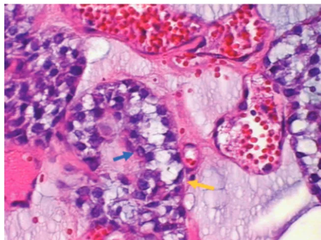 Fig. 1 Patient with an extensive submental mass of a ﬁrm elastic consistency.