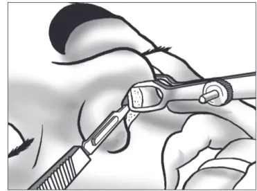 Figura 1.  Anatomia e pontos estéticos da ponta nasal
