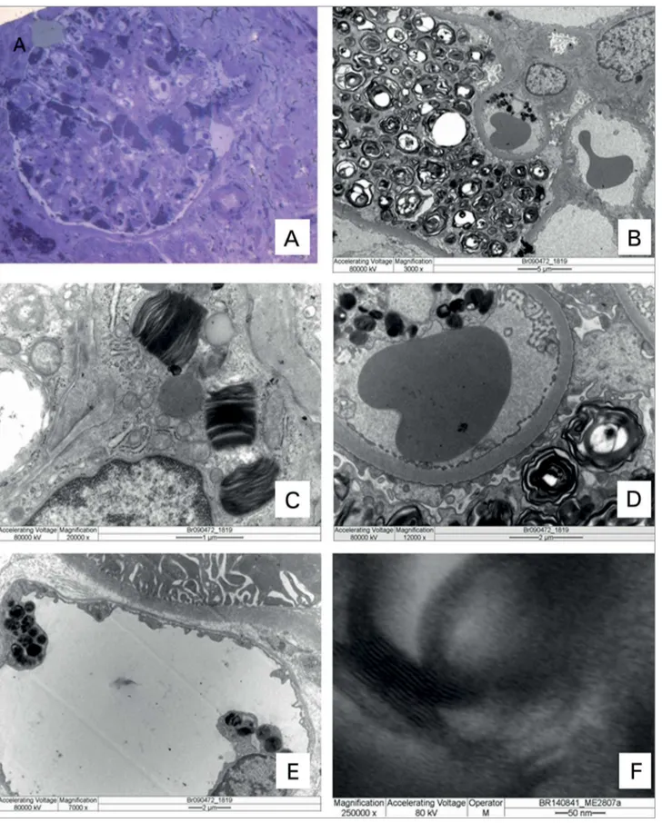 Figura 3. Amostra emblocada em resina, corte semifino, 0,5 µm de espessura, corado pelo Azul de toluidina, sob microscopia de luz comum, os 