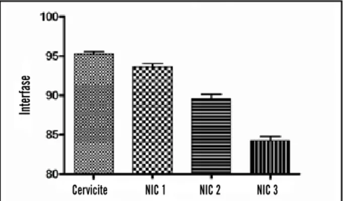 Figura 3 –   Porcentagem decrescente de células em interfase ao longo do espectro  das NICs a partir da categoria cervicite