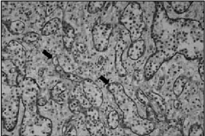 Figura 3 – Marcação com anticorpo anti CD34. As setas pretas indicam as células 