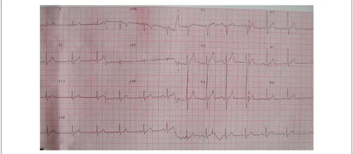 Figure 1 - Normal electrocardiogram.