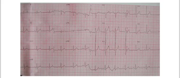 Figure 1 - Normal electrocardiogram.