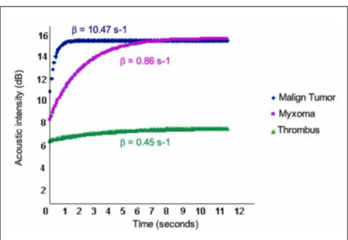 Figure 6 - Curves: Maximum acoustic intensity and mass contrast illing velocity (β)  for each of the cases presented; Malign tumor velocity showed to be much higher  than benign tumor (myxoma); Thrombus quantiication curve was lattened, thus  indicating no