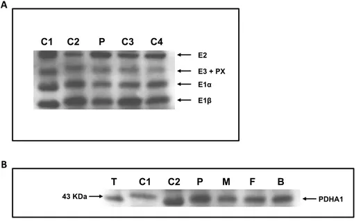 Figure  2.1.  Western  blot  analysis  of  lymphocyte  and  testis  homogenates.  (A)  C1  to  C4  –  control  lymphocytes,  P  –  patient  lymphocytes  (using  the  MitoProfile ®   Pyruvate  dehydrogenase  (PDH)  WB  Antibody  Cocktail);  (B)  T  –  testi