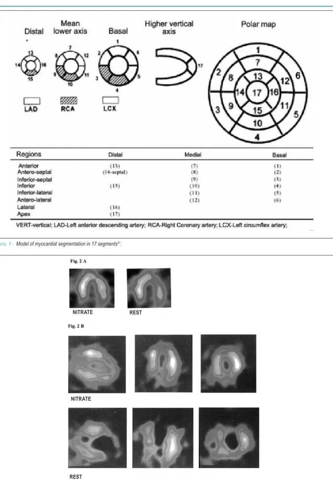 Figure 2 – E��m��� �� MIBI u���k� �m�����m�n� w��� n����g������n� A - m�d����� ����u���k�; B - ������ ����u���k���