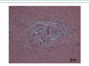 Fig. 6 - Aspecto macroscópico do coração, em que se observa o ventrículo  direito aberto, dilatado, com extensas áreas de fibrose (seta verde; 