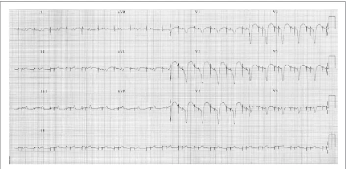 Figure 5 - ECG - �un����n�ng d�u���-���m��� ����m�k�� ���mu����ng ����um� �nd ��n�������� 