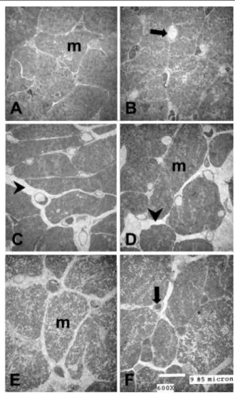 Figure  1  - Ultrathin sections of Epon-embedded tissue blocks of the papillary  muscle of rats from the YC (panels A and B), U (panels C and D), and E (panels  E and F) groups