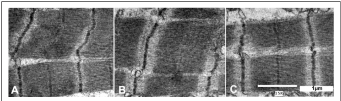 Figure 2 - Ultrathin sections of Epon-embedded tissue blocks of papillary muscle of rats from the YC (panels A), U (Panels B) and E (panels C) groups